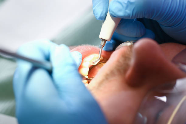 Best Emergency Gum Treatment in Newburyport, MA